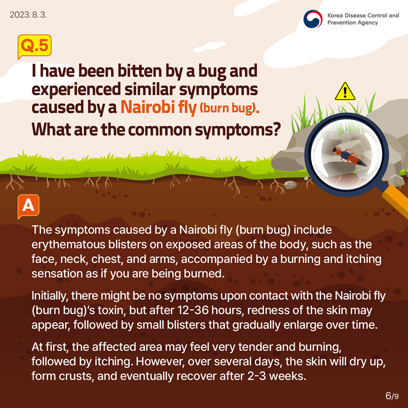 Q5. I have been bitten by a bug and experienced similar symptoms caused by a Nairobi fly (burn bug). What are the common symptoms? The symptoms caused by a Nairobi fly (burn bug) include erythematous blisters on exposed areas of the body, such as the face, neck, chest, and arms, accompanied by a burning and itching sensation as if you are being burned. Initially, there might be no symptoms upon contact with the Nairobi fly (burn bug)’s toxin, but after 12-36 hours, redness of the skin may appear, followed by small blisters that gradually enlarge over time. At first, the affected area may feel very tender and burning, followed by itching. However, over several days, the skin will dry up, form crusts, and eventually recover after 2-3 weeks.